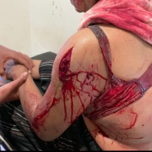 Di Duga alami gangguan jiwa seorang anak Bacok ibu kandung