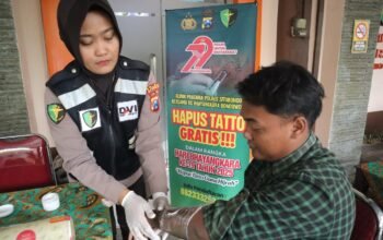 Polres Situbondo Beri Layanan Hapus Tato Gratis di Hari Bhayangkara ke -79