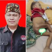 Warga Bayas Jaya Kurang Gizi, Ketua Setwil FPII Lampung Angkat Bicara