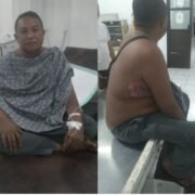 Jurnalis Berinisial SM Alias Samiun Jadi Korban Panah Wayer di Girian, Pemkot dan APH Didesak Bertindak Tegas
